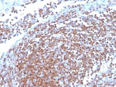 Immunohistochemistry-Paraffin: Cyclin D1 Antibody (CCND1/3370R) [NBP3-07209]