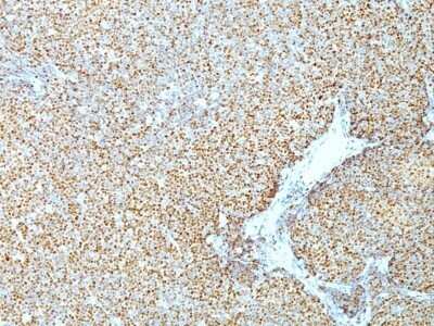 Immunohistochemistry-Paraffin: Cyclin D1 Antibody (CCND1/809) - Azide and BSA Free [NBP2-47921]