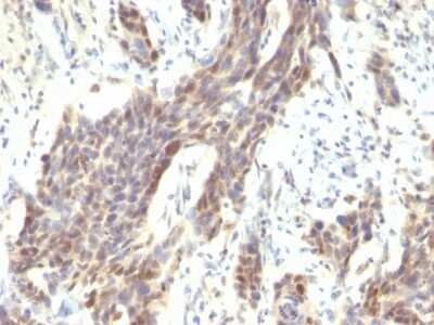 Immunohistochemistry-Paraffin: Cyclin D1 Antibody (CCND1/809) - Azide and BSA Free [NBP2-47921]