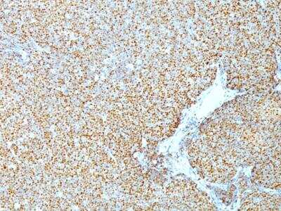 Immunohistochemistry-Paraffin: Cyclin D1 Antibody (CCND1/809) - IHC-Prediluted [NBP2-48127]