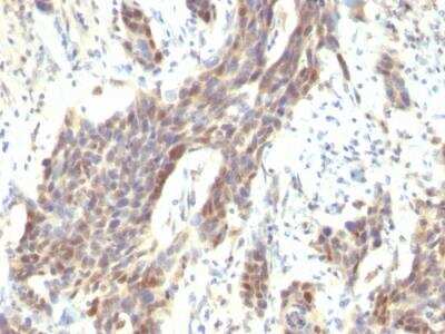 Immunohistochemistry-Paraffin: Cyclin D1 Antibody (CCND1/809) - IHC-Prediluted [NBP2-48127]