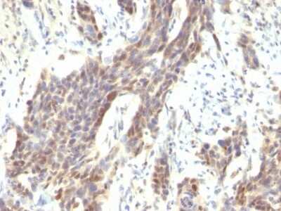 Immunohistochemistry-Paraffin: Cyclin D1 Antibody (CCND1/809) [NBP2-44586]