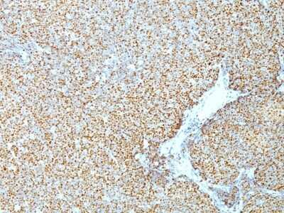 Immunohistochemistry-Paraffin: Cyclin D1 Antibody (CCND1/809) [NBP2-44586]