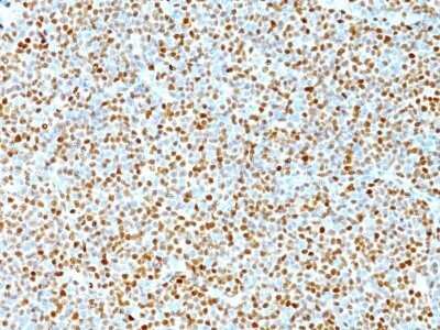 Immunohistochemistry-Paraffin: Cyclin D1 Antibody (DCS-6) - Azide and BSA Free [NBP2-33138]