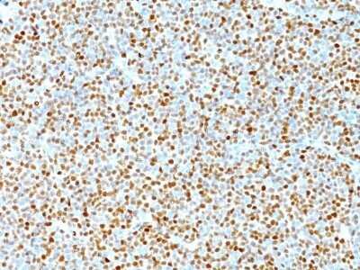 Immunohistochemistry-Paraffin: Cyclin D1 Antibody (DCS-6) - IHC-Prediluted [NBP2-44584]