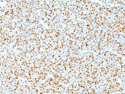 Immunohistochemistry-Paraffin: Cyclin D1 Antibody (DCS-6) [NBP2-15189]