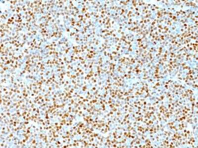 Immunohistochemistry-Paraffin: Cyclin D1 Antibody (DCS-6) [NBP2-15189]