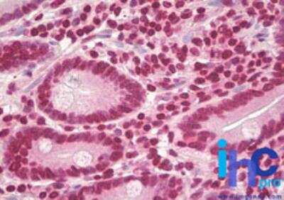 Immunohistochemistry-Paraffin: Cyclin D1 Antibody [NBP2-24695]
