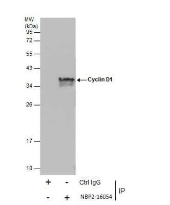 Immunoprecipitation: Cyclin D1 Antibody [NBP2-16054]