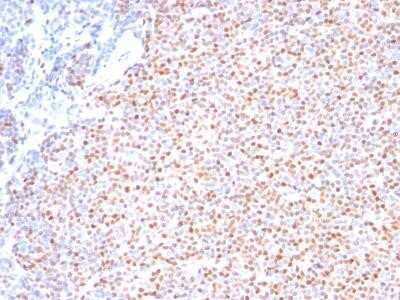 Immunohistochemistry-Paraffin: Cyclin D1 Antibody (SPM587) - Azide and BSA Free [NBP2-34816]