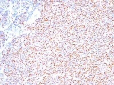 Immunohistochemistry-Paraffin: Cyclin D1 Antibody (SPM587) - IHC-Prediluted [NBP2-44585]