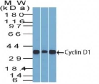 Western Blot: Cyclin D1 Antibody (SPM587) [NBP2-32840]