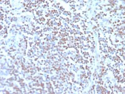 Immunohistochemistry-Paraffin: Cyclin D1 Antibody (rCCND1/4752) - Azide and BSA Free [NBP3-08953]