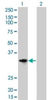 Western Blot: Cyclin D2 Antibody (3B10) [H00000894-M01]