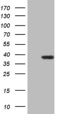 Western Blot: Cyclin D2 Antibody (OTI5A6) [NBP2-46103]