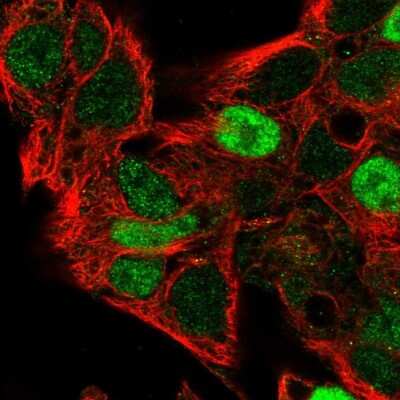 Immunocytochemistry/ Immunofluorescence: Cyclin D2 Antibody [NBP2-14460]