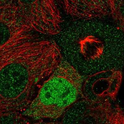 Immunocytochemistry/ Immunofluorescence: Cyclin D2 Antibody [NBP2-58783]