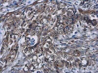 Immunohistochemistry-Paraffin: Cyclin D2 Antibody [NBP3-13225]
