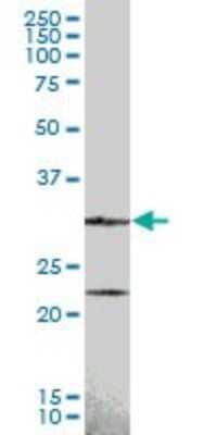 Western Blot: Cyclin D2 Antibody [H00000894-B01P]