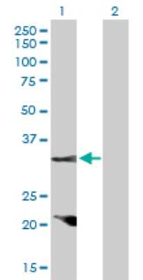 Western Blot: Cyclin D2 Antibody [H00000894-D01P]