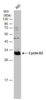 Western Blot: Cyclin D2 Antibody [NBP3-13225]