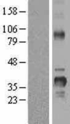 Western Blot: Cyclin D2 Overexpression Lysate [NBL1-08872]