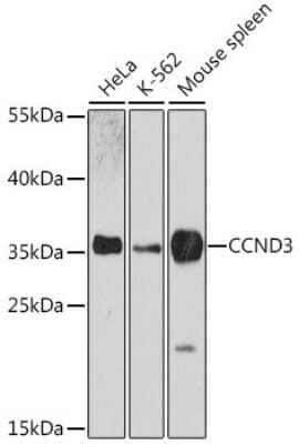 Western Blot: Cyclin D3 AntibodyAzide and BSA Free [NBP2-92937]