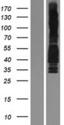 Western Blot: Cyclin D3 Overexpression Lysate [NBP2-04203]