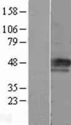 Western Blot: Cyclin E1 Overexpression Lysate [NBL1-08876]