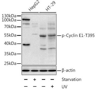 Western Blot: Cyclin E1 [p Thr395] AntibodyBSA Free [NBP3-05378]