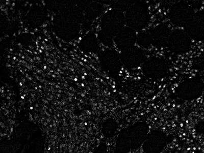 Immunohistochemistry-Paraffin: Cyclin E1 Antibody (CCNE1/2460) - Azide and BSA Free [NBP3-08805]