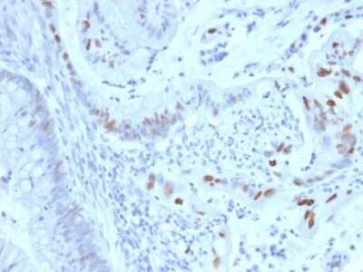 Immunohistochemistry-Paraffin: Cyclin E1 Antibody (CCNE1/2460) [NBP3-07484]