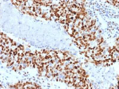 Immunohistochemistry-Paraffin: Cyclin E1 Antibody (CCNE1/2460) - Azide and BSA Free [NBP3-08805]