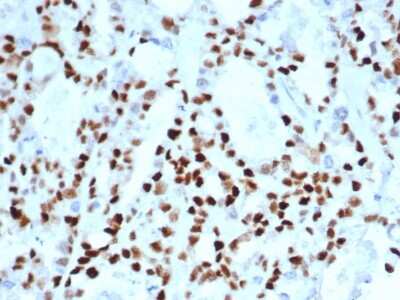 Immunohistochemistry-Paraffin: Cyclin E1 Antibody (CCNE1/4935R) - Azide and BSA Free [NBP3-08810]