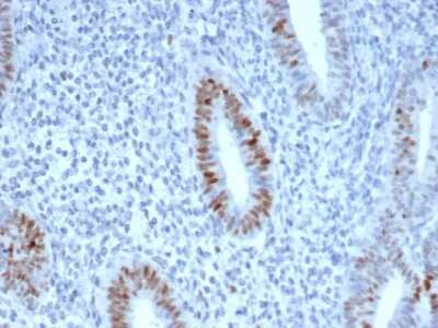 Immunohistochemistry-Paraffin: Cyclin E1 Antibody (CCNE1/4935R) - Azide and BSA Free [NBP3-08810]
