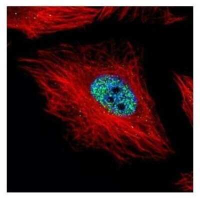 Immunocytochemistry/ Immunofluorescence: Cyclin E1 Antibody [NBP2-16055]