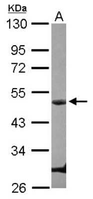 Western Blot: Cyclin E1 Antibody [NBP2-16055]