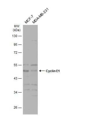 Western Blot: Cyclin E1 Antibody [NBP2-16055]