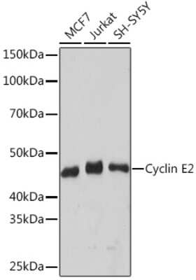 Western Blot: Cyclin E2 Antibody (0Y7G5) [NBP3-16806]