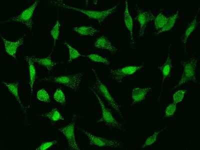 Immunocytochemistry/ Immunofluorescence: Cyclin E2 Antibody [NBP2-99464]