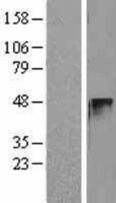 Western Blot: Cyclin E2 Overexpression Lysate [NBL1-08878]