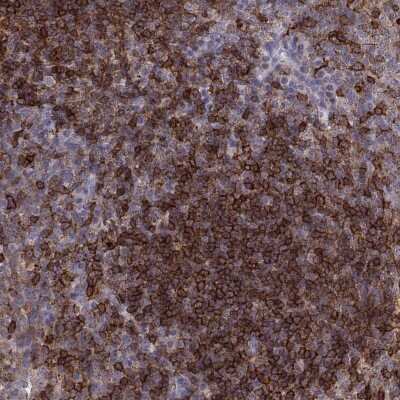 Immunohistochemistry-Paraffin: Cyclin F Antibody [NBP2-57349]