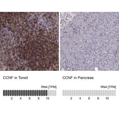 Immunohistochemistry-Paraffin: Cyclin F Antibody [NBP2-57349]