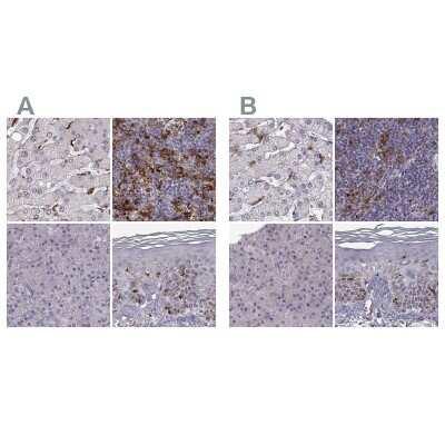 Immunohistochemistry-Paraffin: Cyclin F Antibody [NBP2-57349]