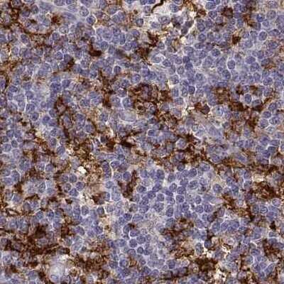 Immunohistochemistry-Paraffin: Cyclin F Antibody [NBP2-57349]