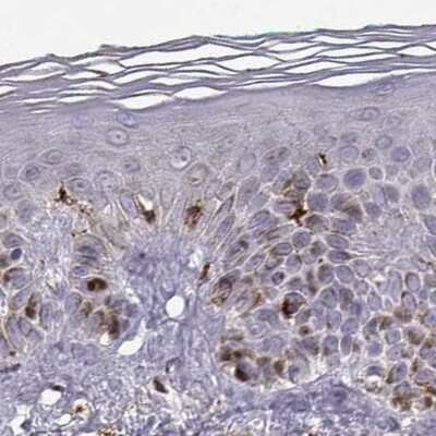 Immunohistochemistry-Paraffin: Cyclin F Antibody [NBP2-57349]