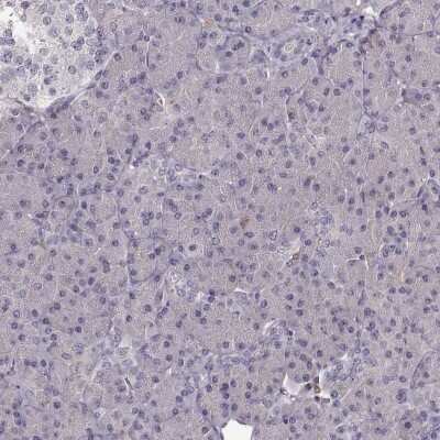 Immunohistochemistry-Paraffin: Cyclin F Antibody [NBP2-57569]
