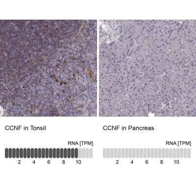 Immunohistochemistry-Paraffin: Cyclin F Antibody [NBP2-57569]