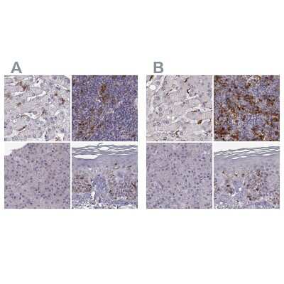 Immunohistochemistry-Paraffin: Cyclin F Antibody [NBP2-57569]