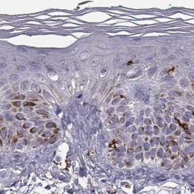 Immunohistochemistry-Paraffin: Cyclin F Antibody [NBP2-57569]
